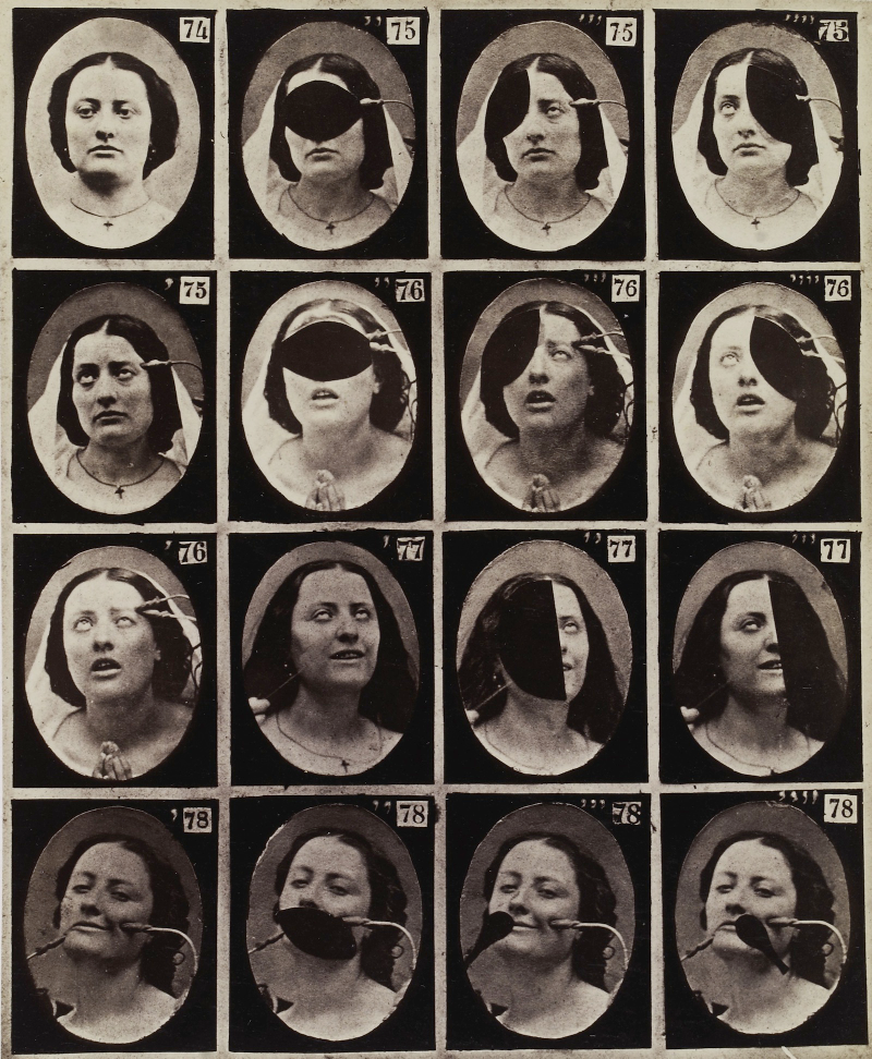 Illustration for article titled Terrifying, Century-Old Photographs from Neuroscience Experiments